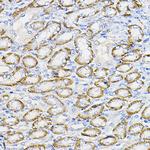 NUBP1 Antibody in Immunohistochemistry (Paraffin) (IHC (P))