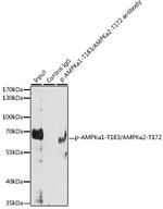 Phospho-AMPK alpha-1,2 (Thr183, Thr172) Antibody in Immunoprecipitation (IP)