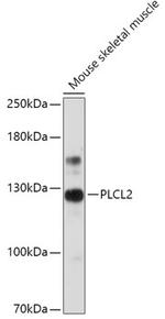 PLCL2 Antibody in Western Blot (WB)