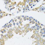 POLG2 Antibody in Immunohistochemistry (Paraffin) (IHC (P))