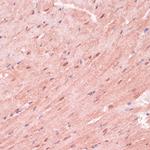 RNF5 Antibody in Immunohistochemistry (Paraffin) (IHC (P))