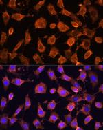 RPL11 Antibody in Immunocytochemistry (ICC/IF)