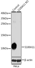 S100A11 Antibody in Western Blot (WB)