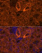 SCNN1G Antibody in Immunohistochemistry (Paraffin) (IHC (P))