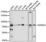 SCNN1G Antibody in Western Blot (WB)