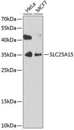 ORNT1 Antibody in Western Blot (WB)