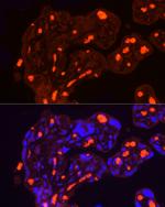 SLC4A1 Antibody in Immunohistochemistry (Paraffin) (IHC (P))