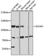 SLC4A1 Antibody in Western Blot (WB)