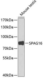 SPAG16 Antibody in Western Blot (WB)