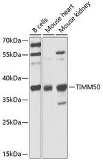 TIMM50 Antibody in Western Blot (WB)