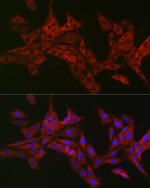 TRAF3IP2 Antibody in Immunocytochemistry (ICC/IF)