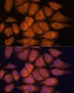 UPF3A Antibody in Immunocytochemistry (ICC/IF)