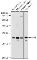 VAPB Antibody in Western Blot (WB)