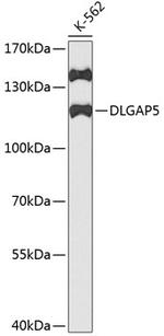 DLG7 Antibody in Western Blot (WB)