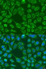 WNT7B Antibody in Immunocytochemistry (ICC/IF)