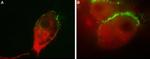 GluR1 (extracellular) Antibody in Immunocytochemistry (ICC/IF)