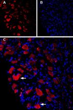 CaV1.3 Antibody in Immunohistochemistry (IHC)