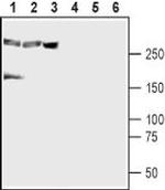 CaV1.3 Antibody in Western Blot (WB)