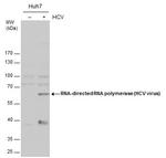 Hepatitis C Virus NS5b Antibody in Western Blot (WB)