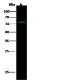 GCM2 Antibody in Western Blot (WB)