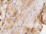 HSPB7 Antibody in Immunohistochemistry (Paraffin) (IHC (P))