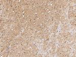 HSPB7 Antibody in Immunohistochemistry (Paraffin) (IHC (P))