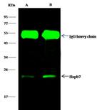 HSPB7 Antibody in Immunoprecipitation (IP)