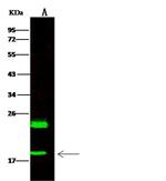 HSPB7 Antibody in Western Blot (WB)