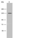 ADAMTS10 Antibody in Western Blot (WB)