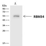 RBM34 Antibody in Immunoprecipitation (IP)