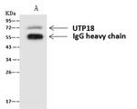 UTP18 Antibody in Immunoprecipitation (IP)