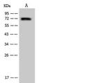 UTP18 Antibody in Western Blot (WB)