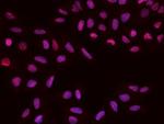 PAPSS1 Antibody in Immunocytochemistry (ICC/IF)