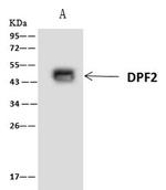DPF2 Antibody in Immunoprecipitation (IP)