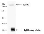 MYH7 Antibody in Immunoprecipitation (IP)