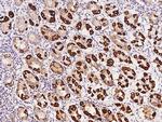 OXCT1 Antibody in Immunohistochemistry (Paraffin) (IHC (P))