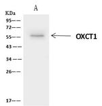 OXCT1 Antibody in Immunoprecipitation (IP)