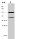 OXCT1 Antibody in Western Blot (WB)