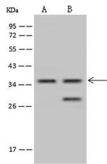 TSEN34 Antibody in Western Blot (WB)