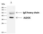 Aldolase C Antibody in Immunoprecipitation (IP)