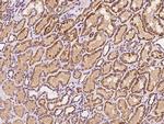 SBCAD Antibody in Immunohistochemistry (Paraffin) (IHC (P))