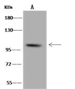B4GALNT3 Antibody in Western Blot (WB)