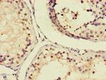 AIM2 Antibody in Immunohistochemistry (Paraffin) (IHC (P))