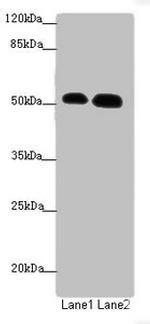 ATMIN Antibody in Western Blot (WB)