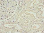 C1GALT1C1 Antibody in Immunohistochemistry (Paraffin) (IHC (P))