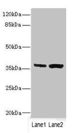 C1GALT1C1 Antibody in Western Blot (WB)