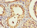 BLOC1S1 Antibody in Immunohistochemistry (Paraffin) (IHC (P))