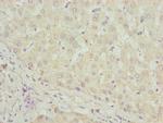 DHRS3 Antibody in Immunohistochemistry (Paraffin) (IHC (P))