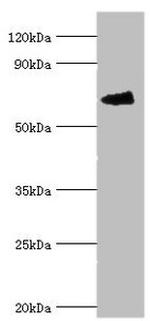 FANCG Antibody in Western Blot (WB)