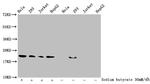 2-hydroxyisobutyryl-Histone H1.2 (Lys26) Antibody in Western Blot (WB)